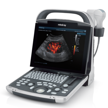 digital-ultrasonic-diagnostic-imaging-system-14