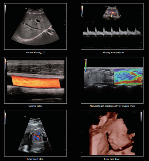 full-hd-ultrasound-459